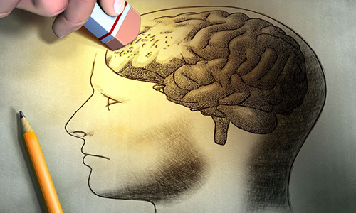 Alzheimer Nedir