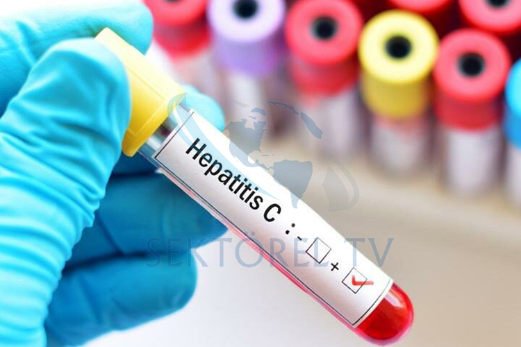 Pandemi döneminde  Hepatit C’ye Muamması